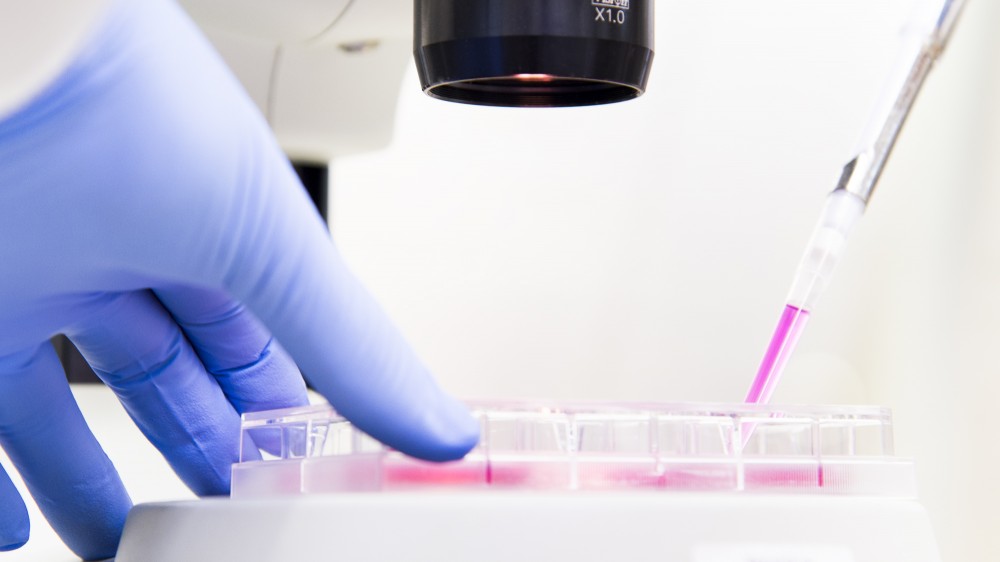 A cell culture plate containing pink liquid under a microscope. A gloved hand is holding the plate while another is pipetting liquid into it.